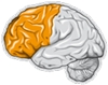 Bild på hjärna vid Frontotemporal demens